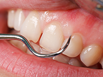 治療終了後のメインテナンス