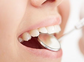 オフィスホワイトニング